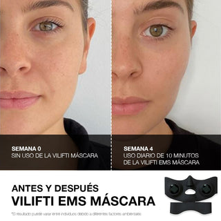 VILIFTI EMS MASCARA MediLift Mascara rejuvenecedoradee stimulacion muscular electrica