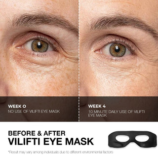 Vilifti FDA-Cleared EMS Rejuvenating Eye Mask for Home Use and Eye Care Yaman Medi Lift Medilift Fitsface