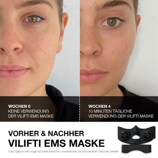 VILIFTI verjüngende Maske mit elektrischer Muskelstimulation Hochleistungs-EMS-Maske