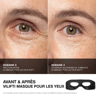 VILIFTI Masque EMS rajeunissant pour les yeux