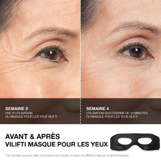 VILIFTI Masque EMS rajeunissant pour les yeux