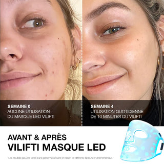 VILIFTI Masque LED 4-en-1