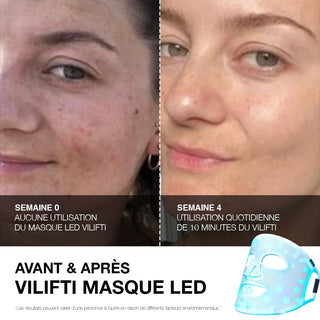 VILIFTI Masque LED 4-en-1