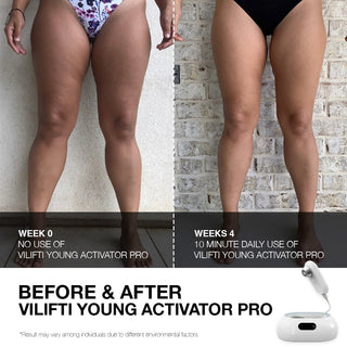 VILIFTI - Young Activator Pro - Slimming & Anti-Ageing Device Maschine - NuBODY - EMS Lifting full body - RF Lifting full body - Tripollar - Wellbox