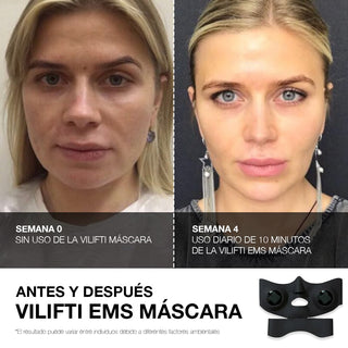 VILIFTI EMS MASCARA MediLift Mascara rejuvenecedoradee stimulacion muscular electrica