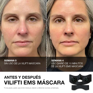 VILIFTI EMS MASCARA MediLift Mascara rejuvenecedoradee stimulacion muscular electrica