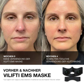 VILIFTI verjüngende Maske mit elektrischer Muskelstimulation Hochleistungs-EMS-Maske