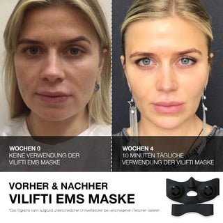 VILIFTI verjüngende Maske mit elektrischer Muskelstimulation Hochleistungs-EMS-Maske