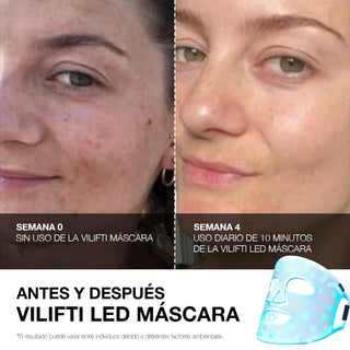 VILIFTI Máscara LED 4-en-1 Facial-Terapia de Luz Roja - Anti Acné - Omnilux - CurentBody - 