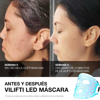 VILIFTI Máscara LED 4-en-1 Facial-Terapia de Luz Roja - Anti Acné - Omnilux - CurentBody - 