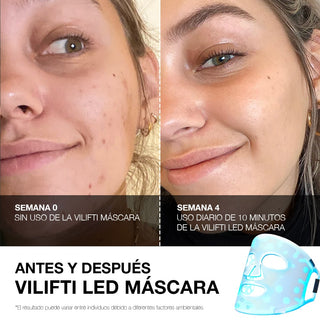 VILIFTI Máscara LED 4-en-1 Facial-Terapia de Luz Roja - Anti Acné - Omnilux - CurentBody - 