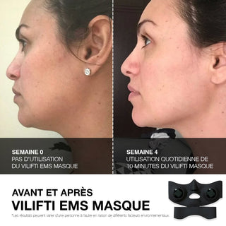 VILIFTI Masque EMS rajeunissant