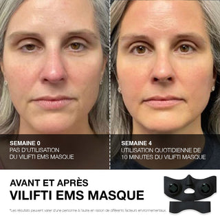 VILIFTI Masque EMS rajeunissant