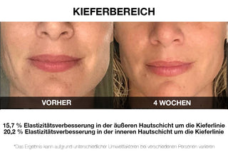 Vilifti verjüngende Maske mit elektrischer Muskelstimulation EMS Maske FACEGYM Medi Lift