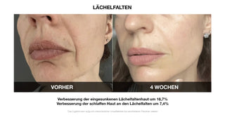 Vilifti verjüngende Maske mit elektrischer Muskelstimulation EMS Maske FACEGYM Medi Lift