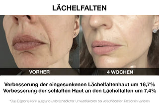 Vilifti verjüngende Maske mit elektrischer Muskelstimulation EMS Maske FACEGYM Medi Lift