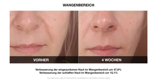 Vilifti verjüngende Maske mit elektrischer Muskelstimulation EMS Maske FACEGYM Medi Lift