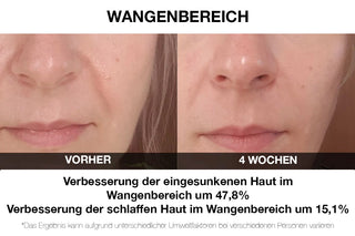 Vilifti verjüngende Maske mit elektrischer Muskelstimulation EMS Maske FACEGYM Medi Lift