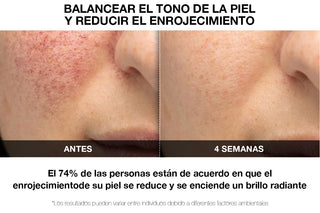 VILIFTI Máscara LED 4-en-1 Facial-Terapia de Luz Roja - Anti Acné - Omnilux - CurentBody 