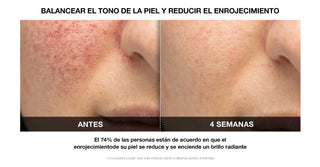 VILIFTI Máscara LED 4-en-1 Facial-Terapia de Luz Roja - Anti Acné - Omnilux - CurentBody 