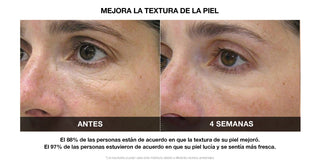 VILIFTI Máscara LED 4-en-1 Facial-Terapia de Luz Roja - Anti Acné - Omnilux - CurentBody 