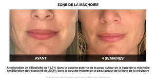VILIFTI_Masque_de_Stimulation_Musculaire_Electrique_Rajeunissant