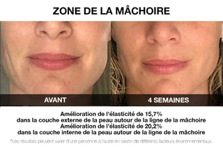 VILIFTI_Masque_de_Stimulation_Musculaire_Electrique_Rajeunissant