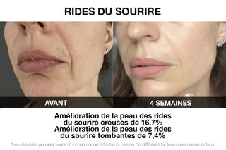 VILIFTI_Masque_de_Stimulation_Musculaire_Electrique_Rajeunissant