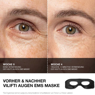 VILIFTI Augen verjüngende EMS Maske