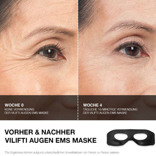 VILIFTI Augen verjüngende EMS Maske