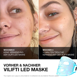 VILIFTI LED 4-in-1 Lichttherapie Maske