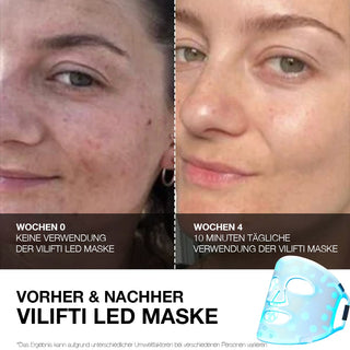 VILIFTI LED 4-in-1 Lichttherapie Maske