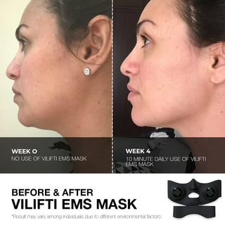 Vilifti EMS Rejuvenating Face Eye Mask for Eye Contouring and Facial Toning Yaman Medi Lift Medilift Fitsface