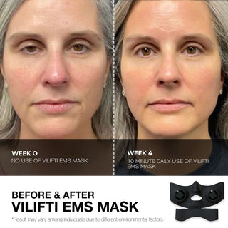 Vilifti Innovative EMS Face Mask for Facial Workout and Contouring Yaman Medi Lift Medilift Fitsface