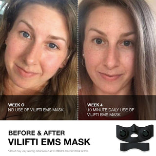 Professional EMS Face Mask for Wrinkle Reduction and Skin Lifting