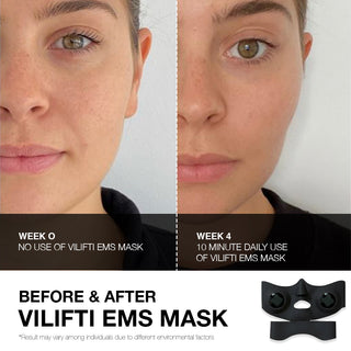 Vilifti EMS Face Mask with Microcurrent Technology for Skin Tightening Yaman Medi Lift Medilift Fitsface Face Yoga