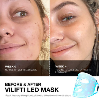 Vilifti FDA-Approved LED Face Mask for Home Use Omnilux SolaWave Currentbody Foreo